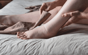 Lymphedema Care with Compression Stockings